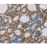 Immunohistochemistry - RUNX1T1 Antibody from Signalway Antibody (37883) - Antibodies.com