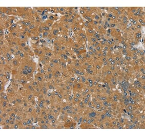 Immunohistochemistry - SEMA6D Antibody from Signalway Antibody (37907) - Antibodies.com