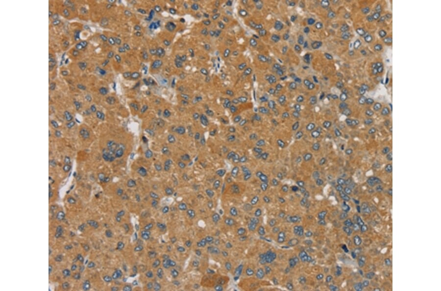Immunohistochemistry - SEMA6D Antibody from Signalway Antibody (37907) - Antibodies.com