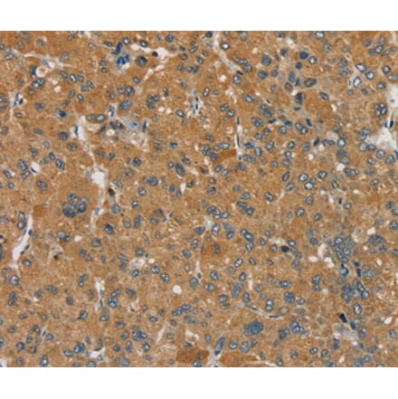 Immunohistochemistry - SEMA6D Antibody from Signalway Antibody (37907) - Antibodies.com