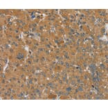 Immunohistochemistry - SEMA6D Antibody from Signalway Antibody (37907) - Antibodies.com