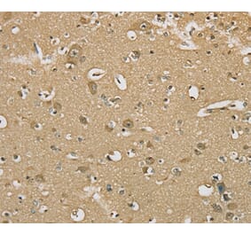 Immunohistochemistry - SERINC1 Antibody from Signalway Antibody (37911) - Antibodies.com