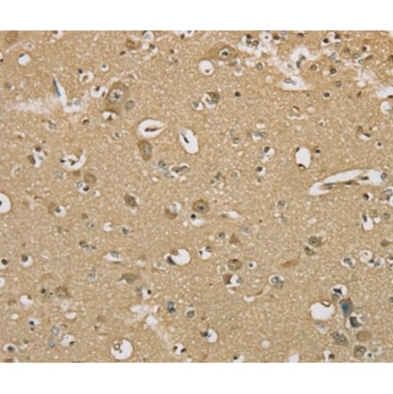 Immunohistochemistry - SERINC1 Antibody from Signalway Antibody (37911) - Antibodies.com
