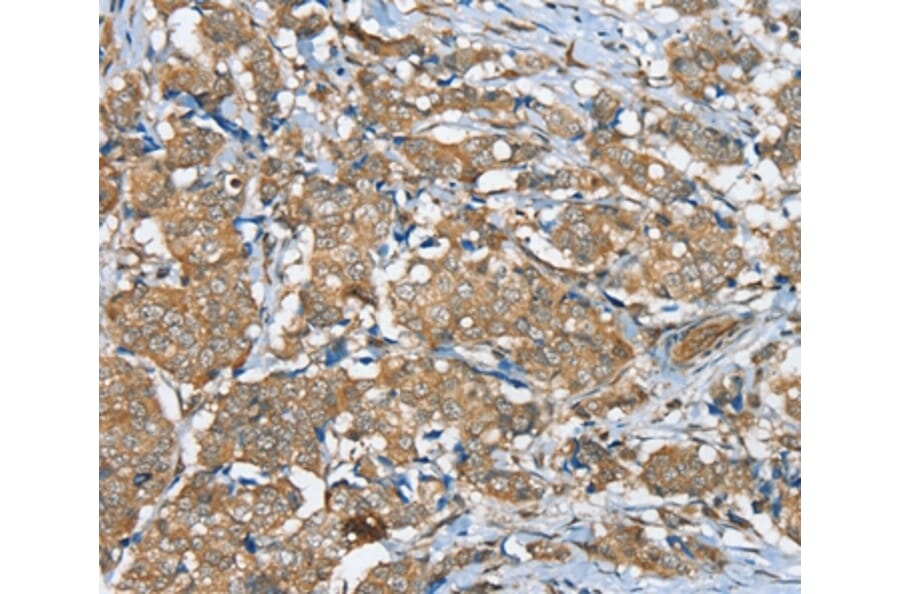 Immunohistochemistry - SERINC3 Antibody from Signalway Antibody (37913) - Antibodies.com