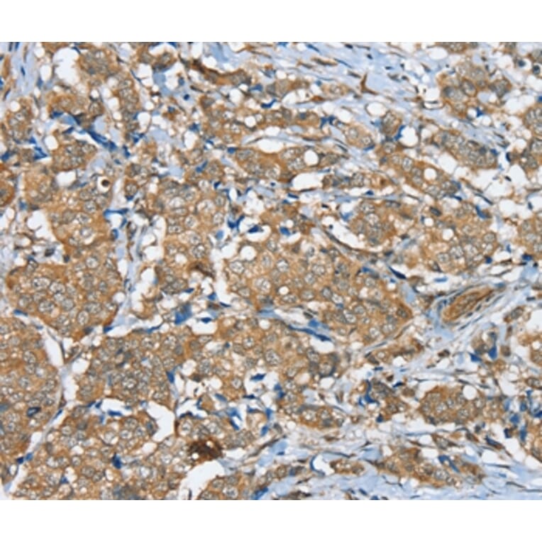 Immunohistochemistry - SERINC3 Antibody from Signalway Antibody (37913) - Antibodies.com