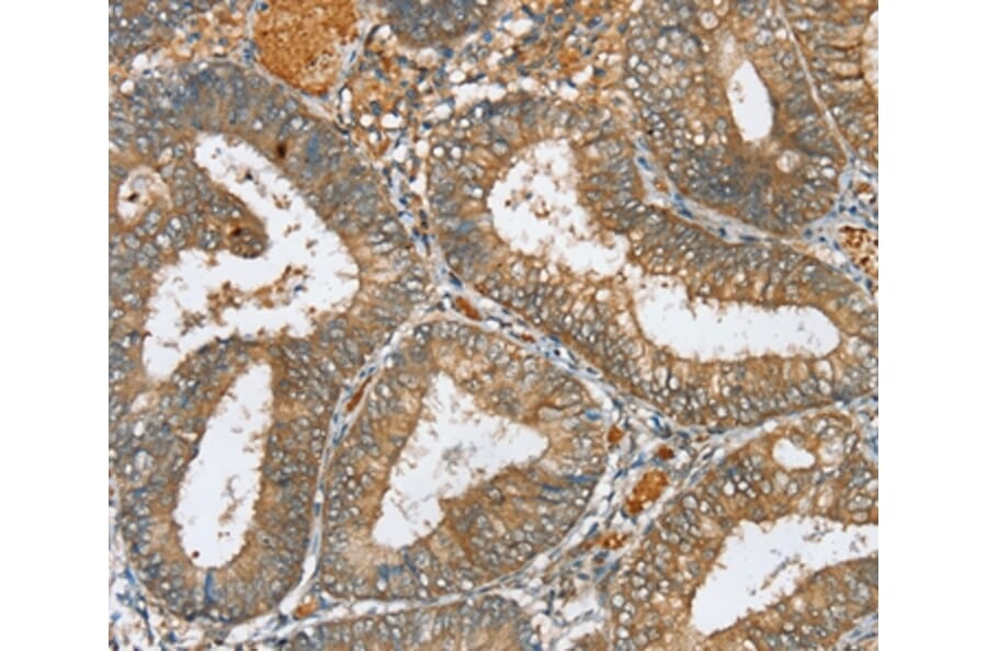 Immunohistochemistry - SERINC3 Antibody from Signalway Antibody (37913) - Antibodies.com