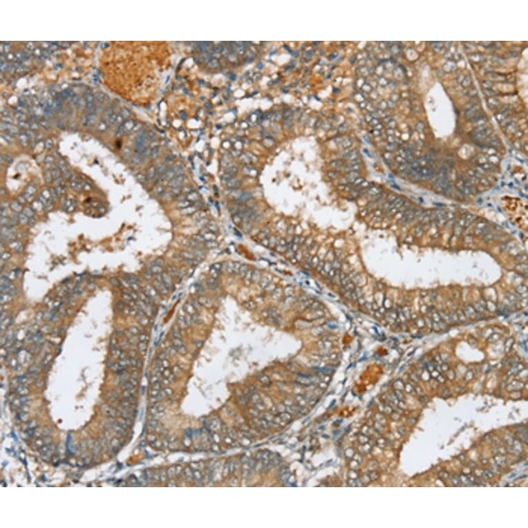 Immunohistochemistry - SERINC3 Antibody from Signalway Antibody (37913) - Antibodies.com