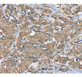 Immunohistochemistry - SERINC4 Antibody from Signalway Antibody (37914) - Antibodies.com