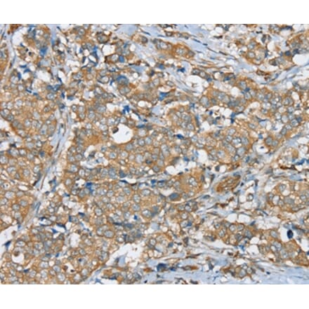 Immunohistochemistry - SERINC4 Antibody from Signalway Antibody (37914) - Antibodies.com