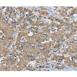 Immunohistochemistry - SERINC4 Antibody from Signalway Antibody (37914) - Antibodies.com