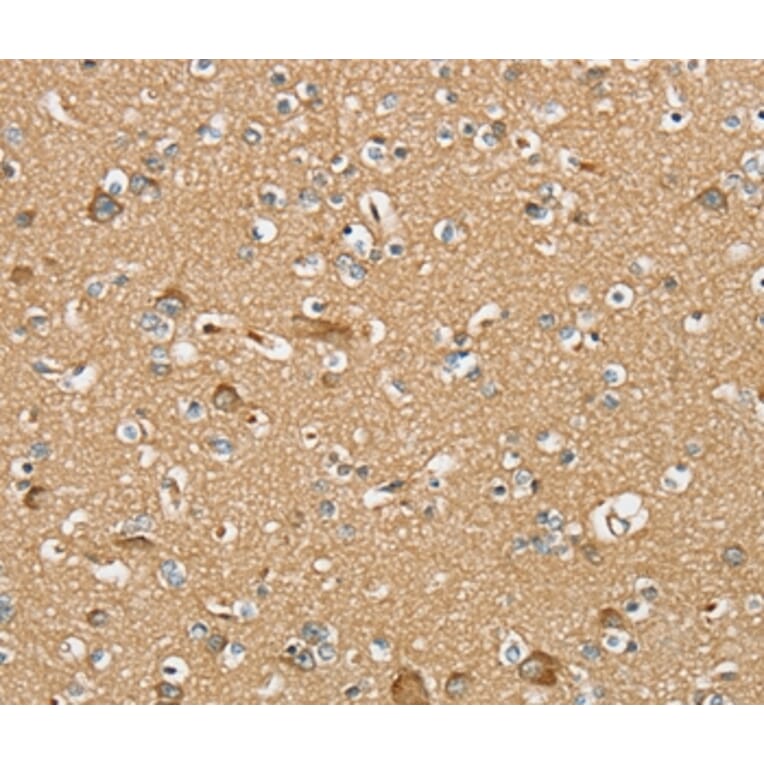 Immunohistochemistry - SERINC4 Antibody from Signalway Antibody (37914) - Antibodies.com