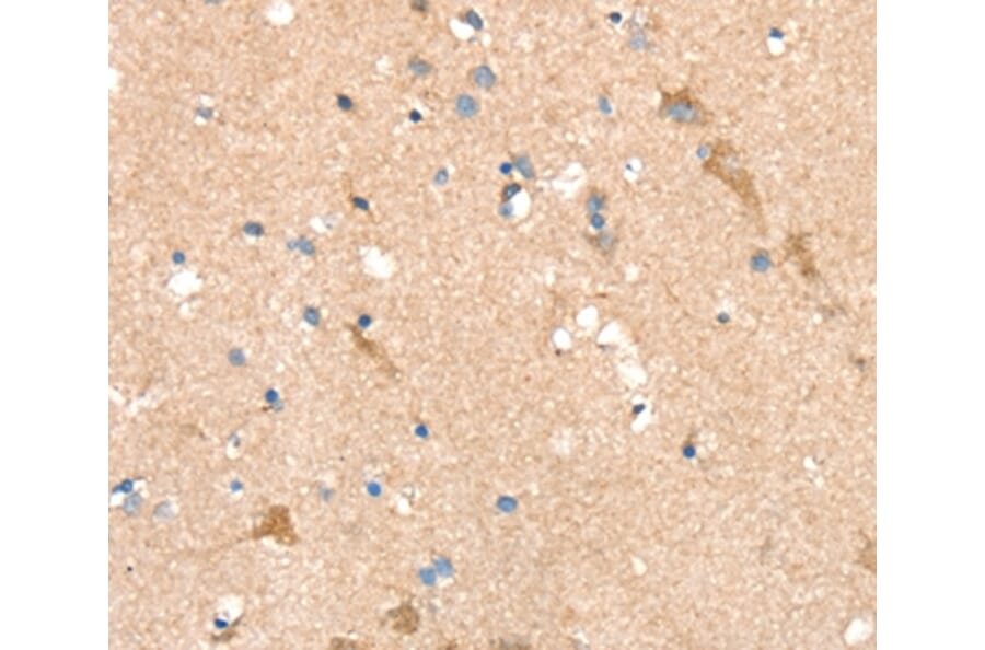 Immunohistochemistry - SIGLEC8 Antibody from Signalway Antibody (37922) - Antibodies.com