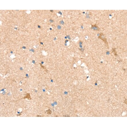 Immunohistochemistry - SIGLEC8 Antibody from Signalway Antibody (37922) - Antibodies.com