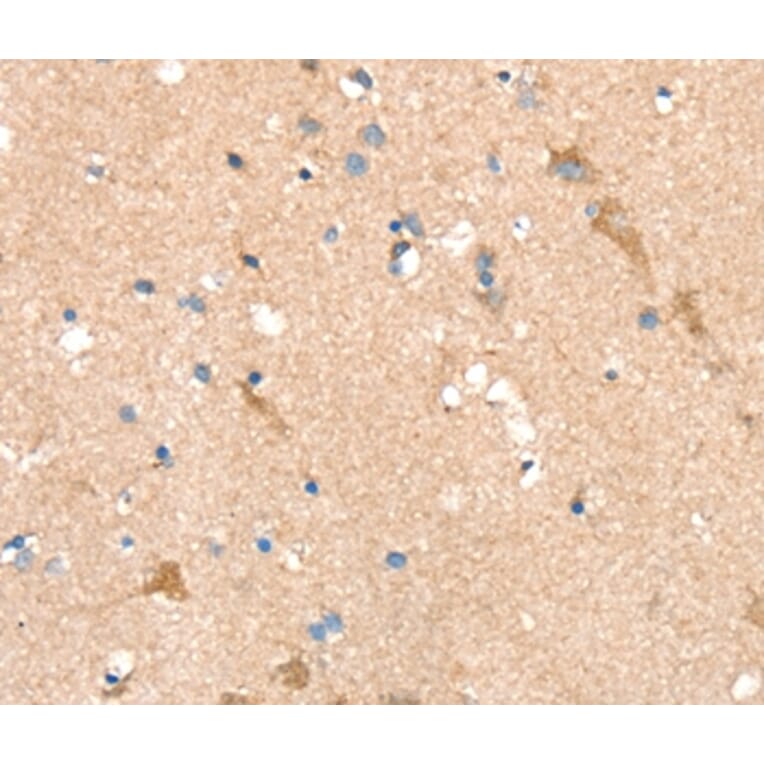 Immunohistochemistry - SIGLEC8 Antibody from Signalway Antibody (37922) - Antibodies.com