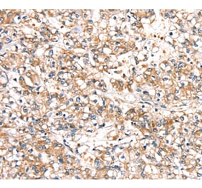Immunohistochemistry - SLC24A3 Antibody from Signalway Antibody (37933) - Antibodies.com