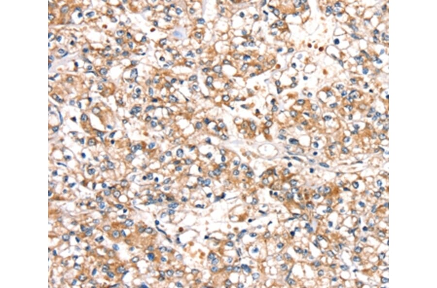Immunohistochemistry - SLC24A3 Antibody from Signalway Antibody (37933) - Antibodies.com