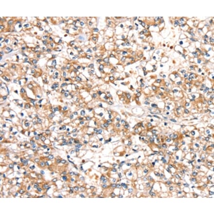 Immunohistochemistry - SLC24A3 Antibody from Signalway Antibody (37933) - Antibodies.com