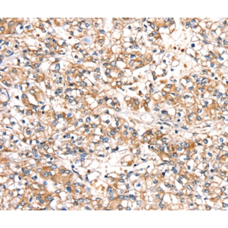 Immunohistochemistry - SLC24A3 Antibody from Signalway Antibody (37933) - Antibodies.com