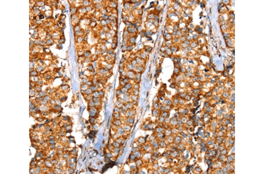 Immunohistochemistry - SLC25A3 Antibody from Signalway Antibody (37937) - Antibodies.com