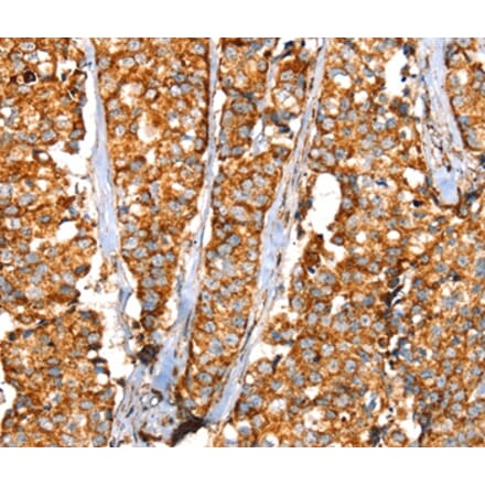 Immunohistochemistry - SLC25A3 Antibody from Signalway Antibody (37937) - Antibodies.com