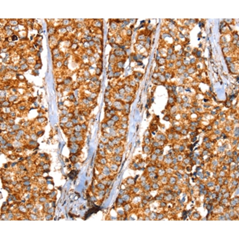Immunohistochemistry - SLC25A3 Antibody from Signalway Antibody (37937) - Antibodies.com