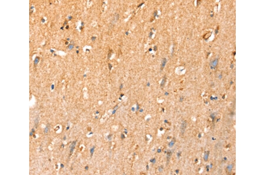 Immunohistochemistry - SLC25A3 Antibody from Signalway Antibody (37937) - Antibodies.com