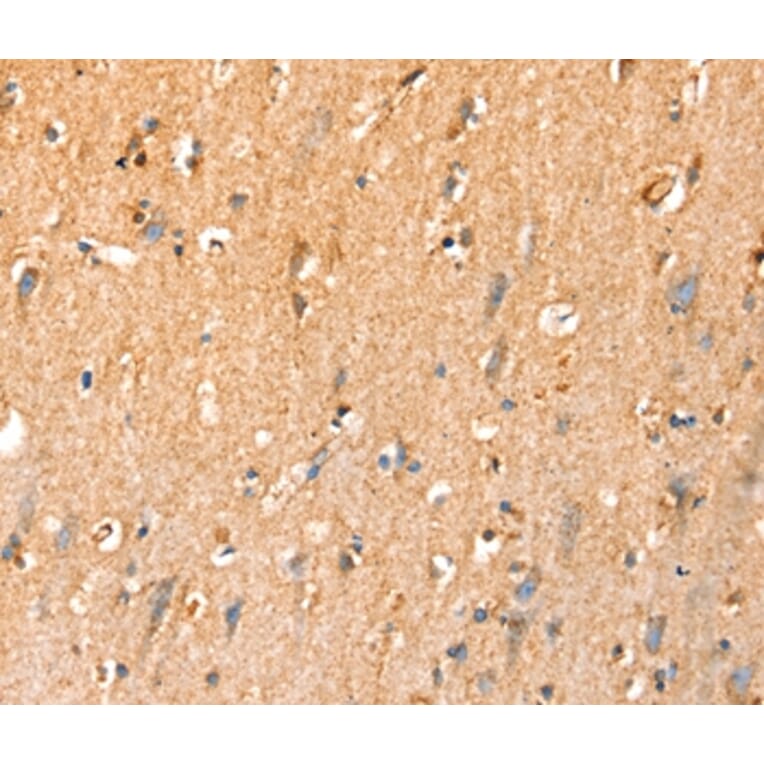 Immunohistochemistry - SLC25A3 Antibody from Signalway Antibody (37937) - Antibodies.com