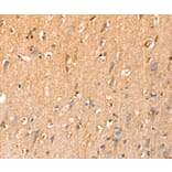 Immunohistochemistry - SLC25A3 Antibody from Signalway Antibody (37937) - Antibodies.com