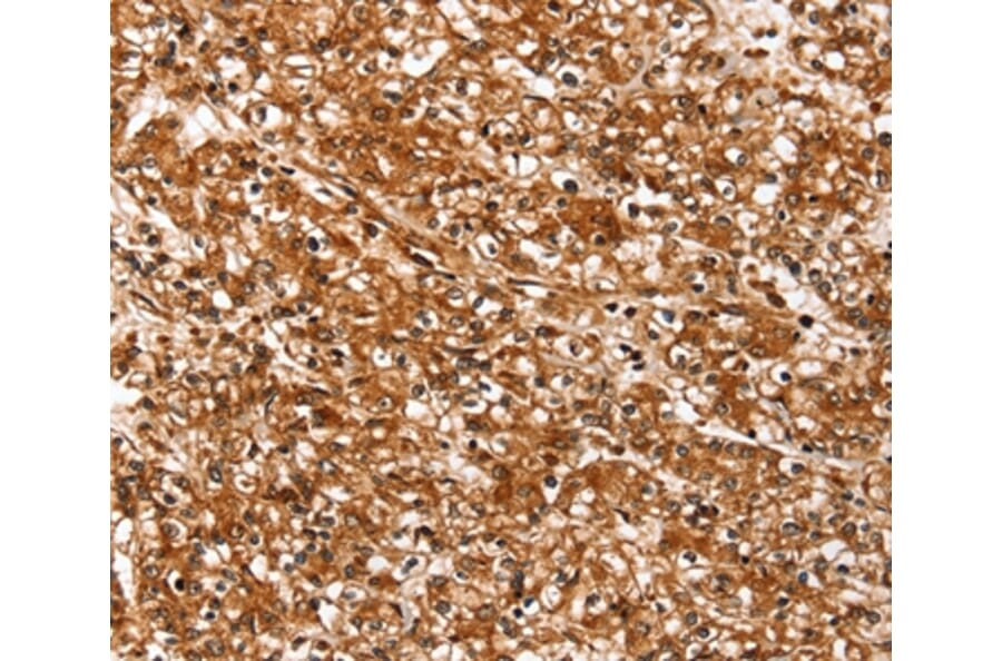 Immunohistochemistry - SLC26A5 Antibody from Signalway Antibody (37938) - Antibodies.com