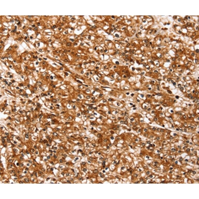 Immunohistochemistry - SLC26A5 Antibody from Signalway Antibody (37938) - Antibodies.com