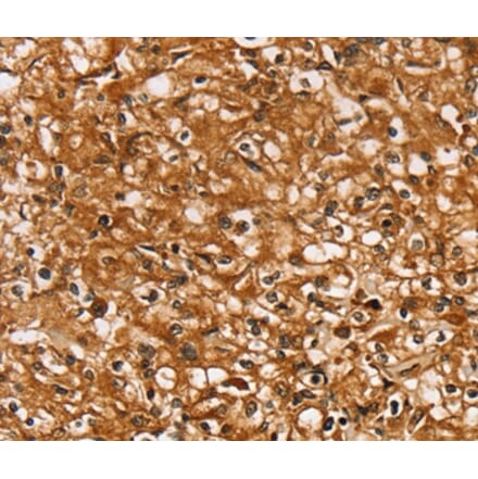 Immunohistochemistry - SLC26A6 Antibody from Signalway Antibody (37939) - Antibodies.com