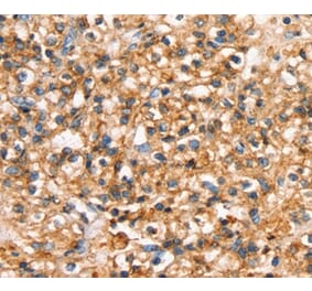 Immunohistochemistry - SLC34A3 Antibody from Signalway Antibody (37940) - Antibodies.com