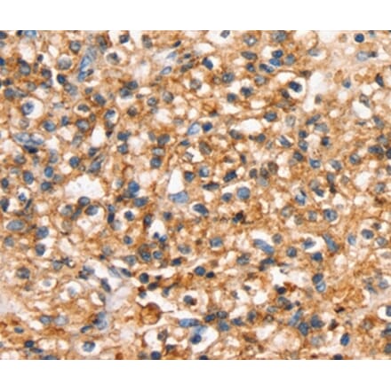 Immunohistochemistry - SLC34A3 Antibody from Signalway Antibody (37940) - Antibodies.com