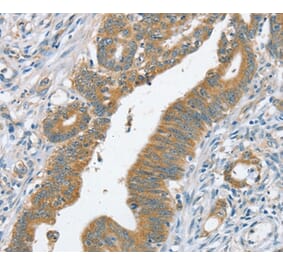 Immunohistochemistry - SLC39A3 Antibody from Signalway Antibody (37941) - Antibodies.com