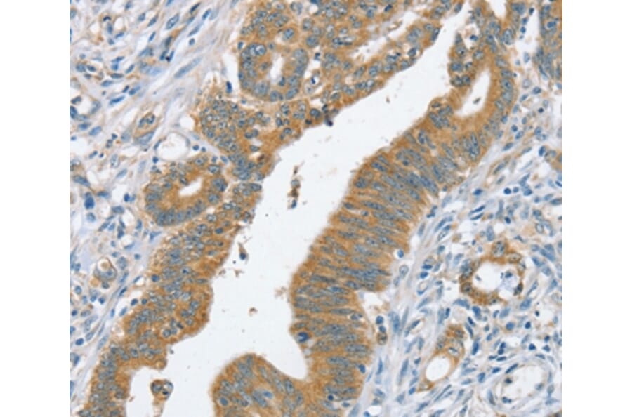 Immunohistochemistry - SLC39A3 Antibody from Signalway Antibody (37941) - Antibodies.com