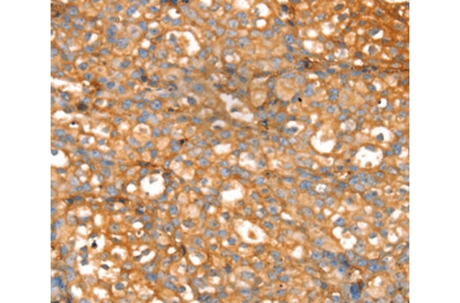 Immunohistochemistry - SLC39A9 Antibody from Signalway Antibody (37942) - Antibodies.com