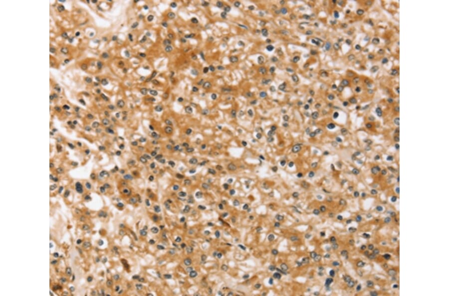 Immunohistochemistry - SLC40A1 Antibody from Signalway Antibody (37943) - Antibodies.com