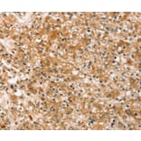 Immunohistochemistry - SLC40A1 Antibody from Signalway Antibody (37943) - Antibodies.com