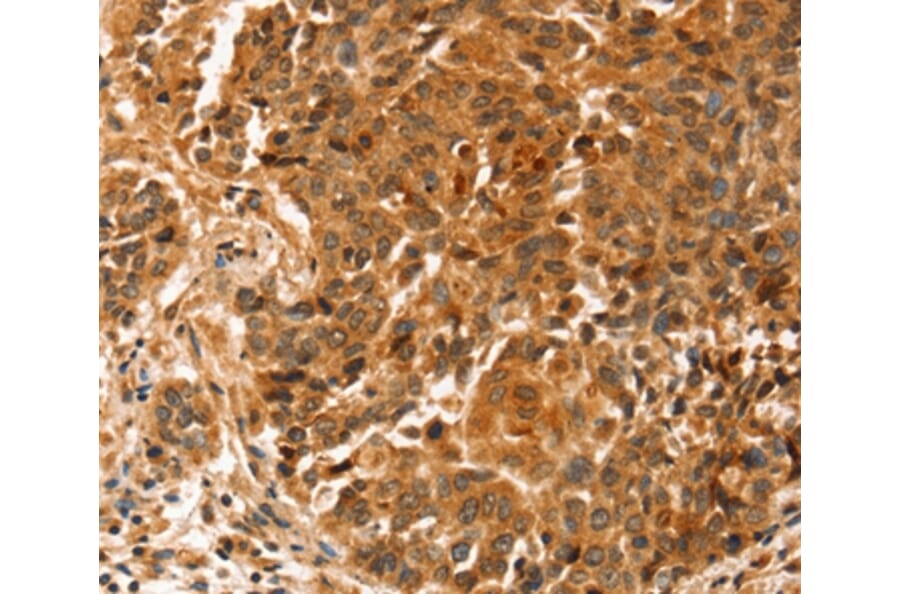 Immunohistochemistry - SLC41A2 Antibody from Signalway Antibody (37944) - Antibodies.com
