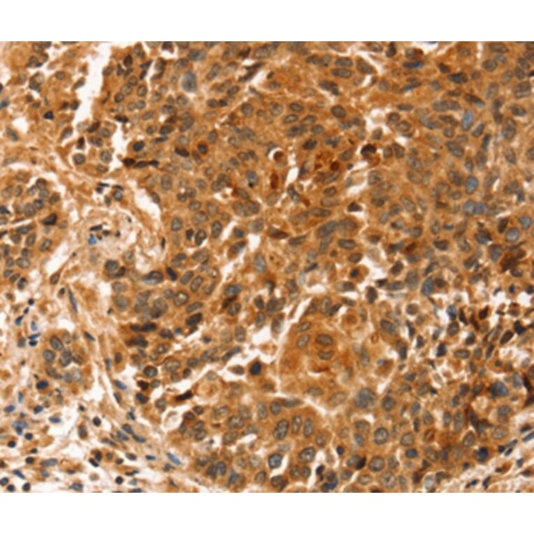 Immunohistochemistry - SLC41A2 Antibody from Signalway Antibody (37944) - Antibodies.com