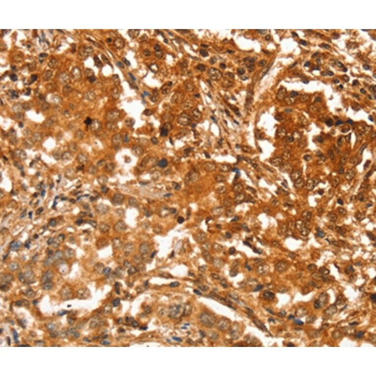 Immunohistochemistry - SLC41A2 Antibody from Signalway Antibody (37944) - Antibodies.com