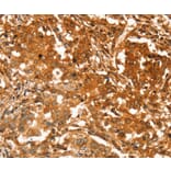 Immunohistochemistry - SLC41A2 Antibody from Signalway Antibody (37944) - Antibodies.com