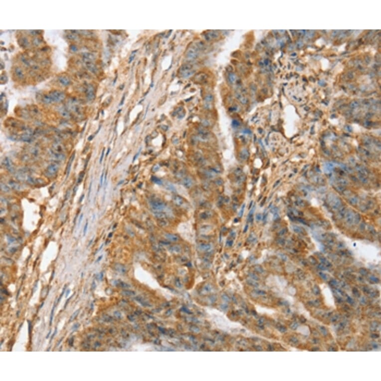 Immunohistochemistry - SLC41A3 Antibody from Signalway Antibody (37945) - Antibodies.com