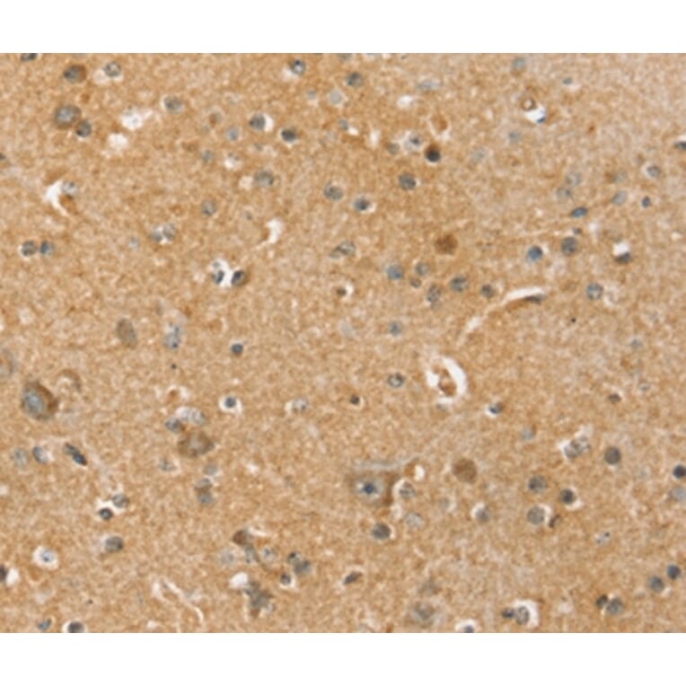 Immunohistochemistry - SLC41A3 Antibody from Signalway Antibody (37945) - Antibodies.com