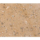 Immunohistochemistry - SLC41A3 Antibody from Signalway Antibody (37945) - Antibodies.com