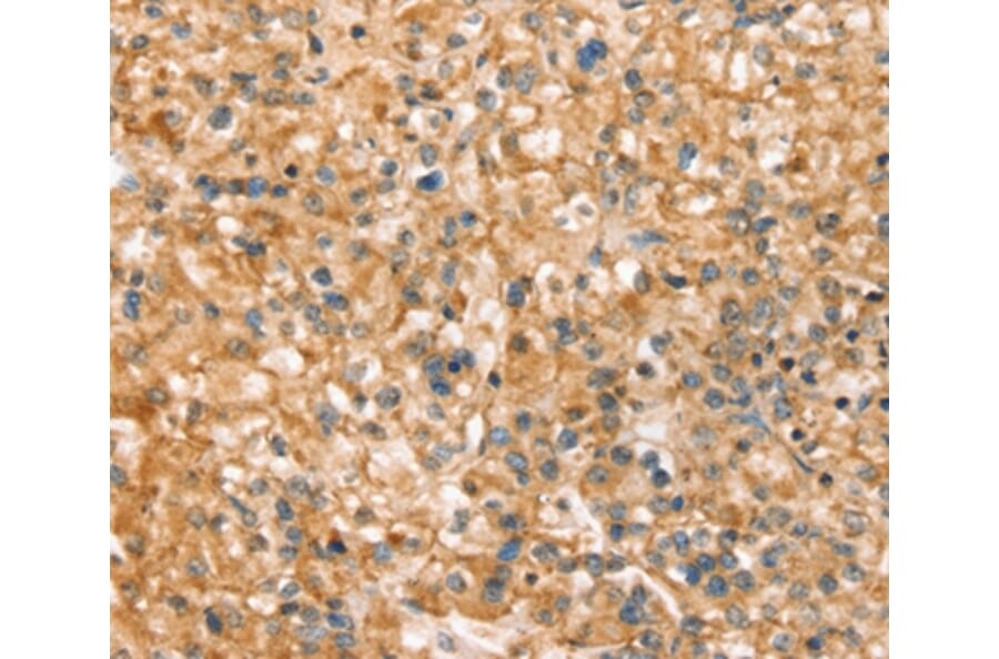 Immunohistochemistry - SLC43A2 Antibody from Signalway Antibody (37946) - Antibodies.com