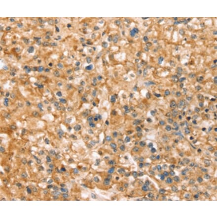 Immunohistochemistry - SLC43A2 Antibody from Signalway Antibody (37946) - Antibodies.com