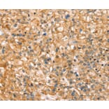 Immunohistochemistry - SLC43A2 Antibody from Signalway Antibody (37946) - Antibodies.com