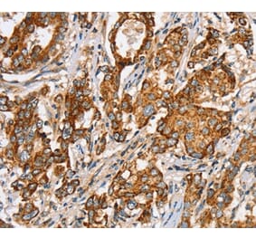 Immunohistochemistry - SLC5A11 Antibody from Signalway Antibody (37947) - Antibodies.com
