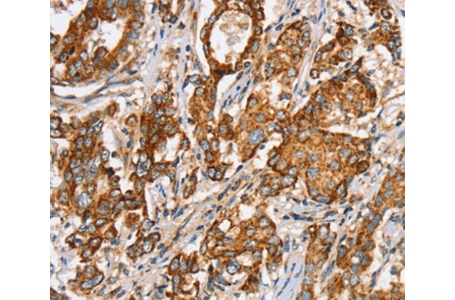 Immunohistochemistry - SLC5A11 Antibody from Signalway Antibody (37947) - Antibodies.com